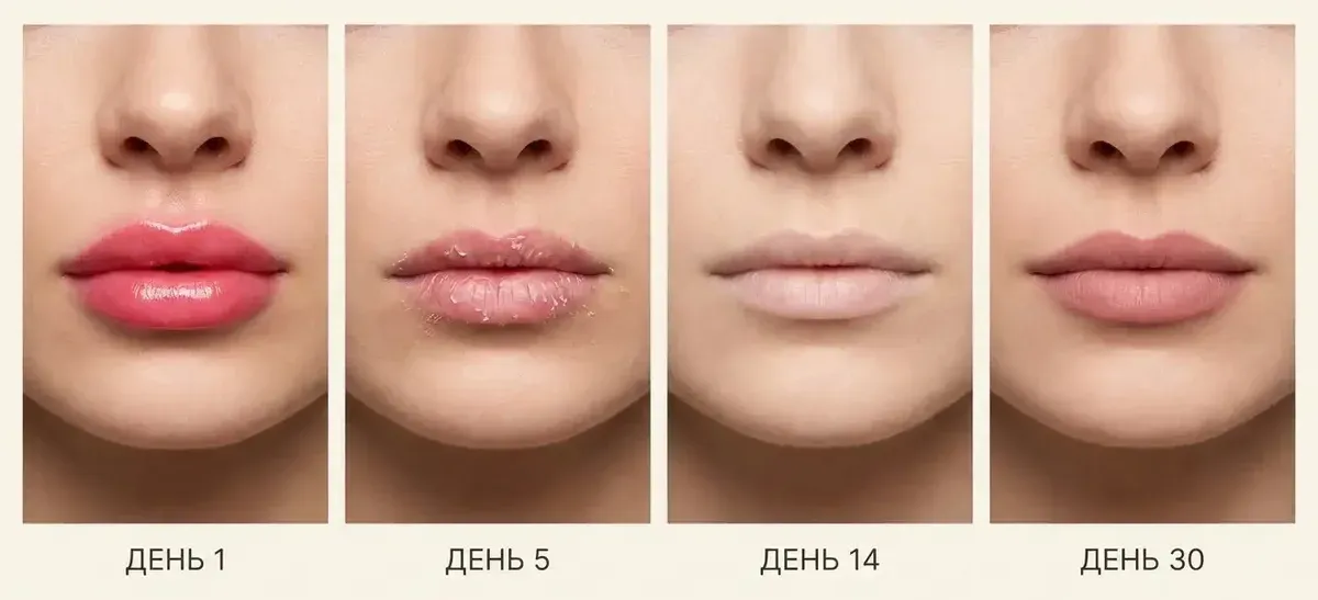 Как меняется цвет перманента губ: день 1 ярко, день 5 шелушение, день 14 бледно, день 30 цвет проявился