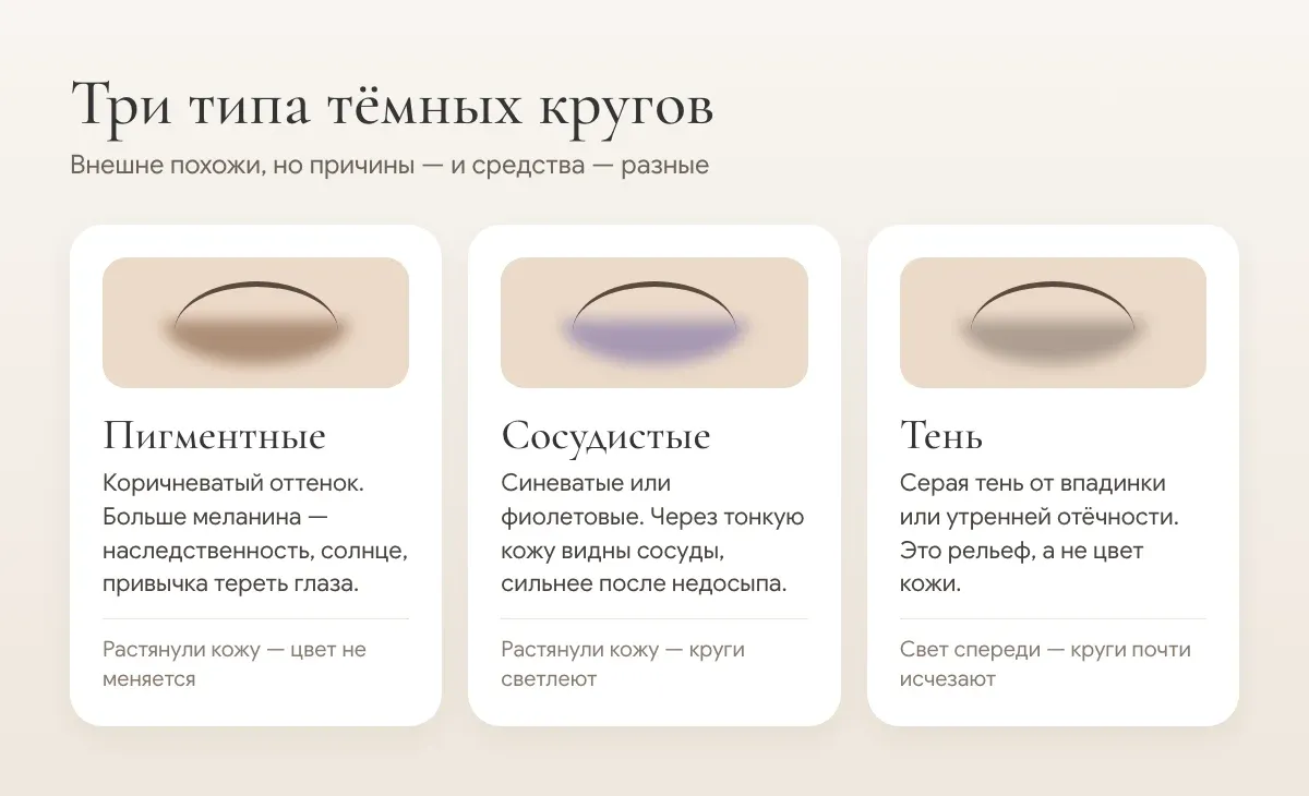 Три типа тёмных кругов: пигментные, сосудистые и тень от рельефа